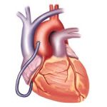 علاج: دل کے مریضو ں کے لیے
